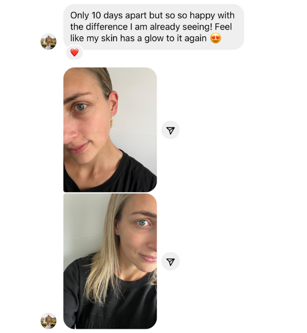 Hydrate + Renew Bundle