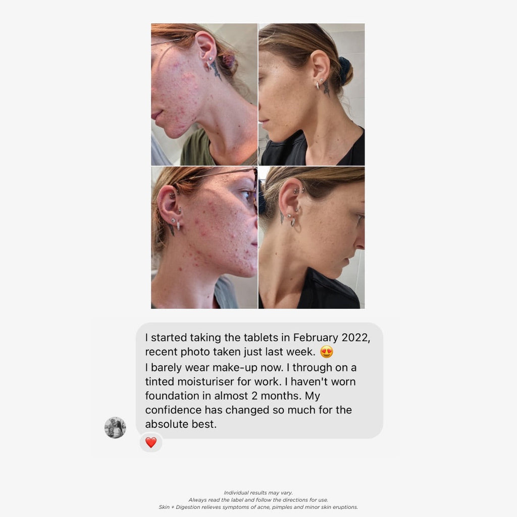 Skin + Digestion Formula - 1 Month Supply