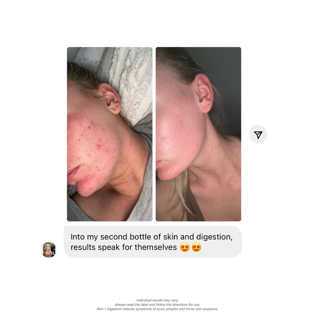 Skin + Digestion Formula - 1 Month Supply
