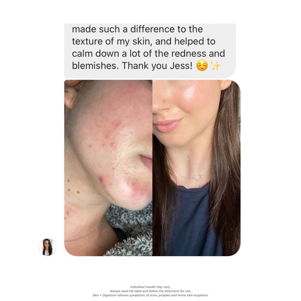 Skin + Digestion Formula - 1 Month Supply