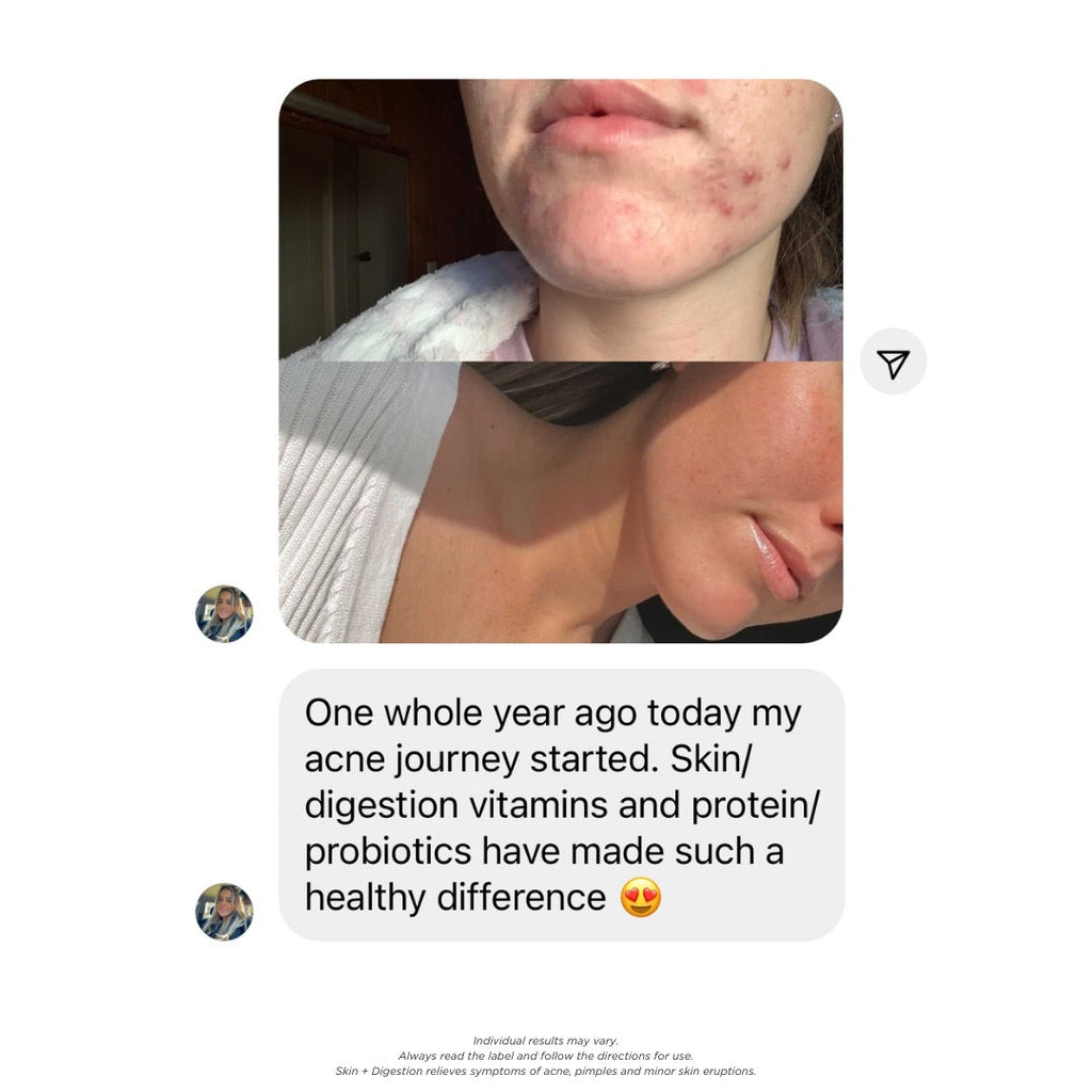 Skin + Digestion Formula - 1 Month Supply